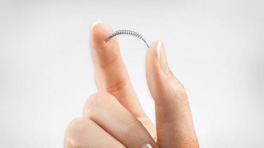 Essure problems with defective device