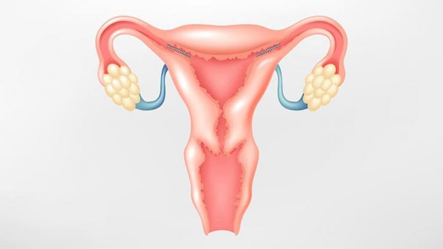 safety of essure devices